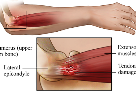 Untitled Physiotherapists Northlakes