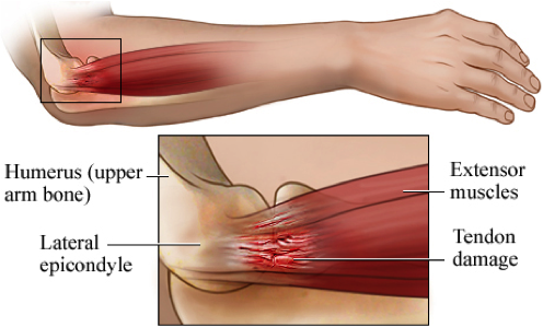 Untitled Physiotherapists Northlakes