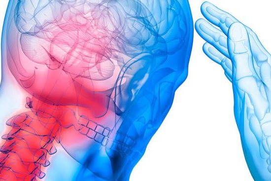 headache Physiotherapists Caboolture